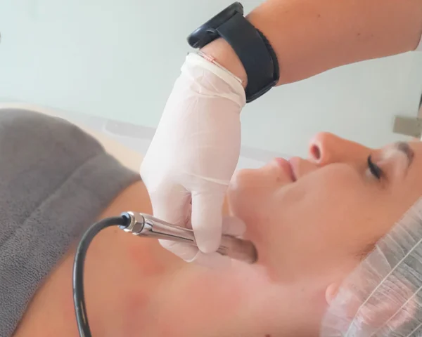 Facial Treatments 10 13