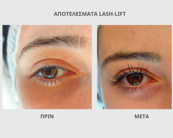 Facial Treatments 27 465565