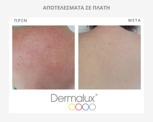 Facial Treatments 15 πριν (1)