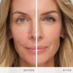 HydroPureTintedSerum before and after svetlana