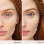 IC EnlightenPlus Before After NO0 Ace
