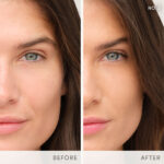 IC EnlightenPlus Before After NO2 Gabrielle