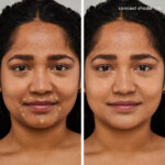 PureMatchConcealer BA 10N nisat8
