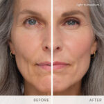 before and after maryanne
