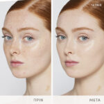 Skintuition BAs 14FairLight