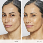 Skintuition BAs 48Medium