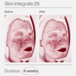 Skin Integrate 28 10 Skin Integrate 28 ελλαδα