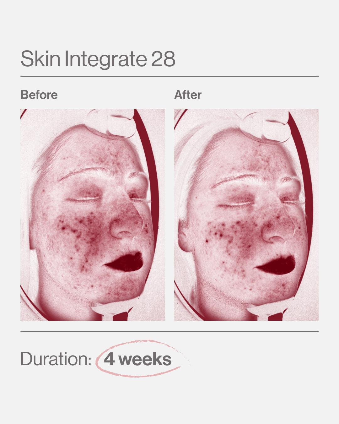 Skin Integrate 28 ελλαδα