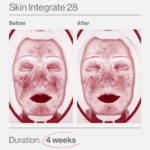 Skin Integrate 28 12 Skin Integrate 28 ελλαδα