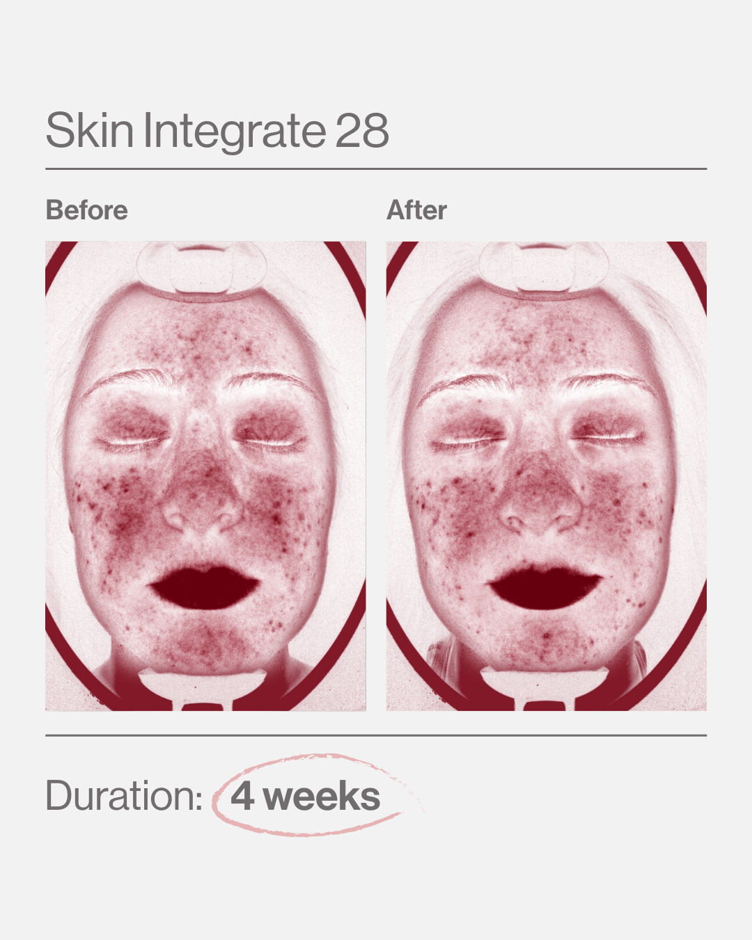 Skin Integrate 28 ελλαδα