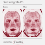 Skin Integrate 28 11 Skin Integrate 28 ελλαδα