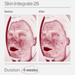 Skin Integrate 28 9 Skin Integrate 28 ελλαδα