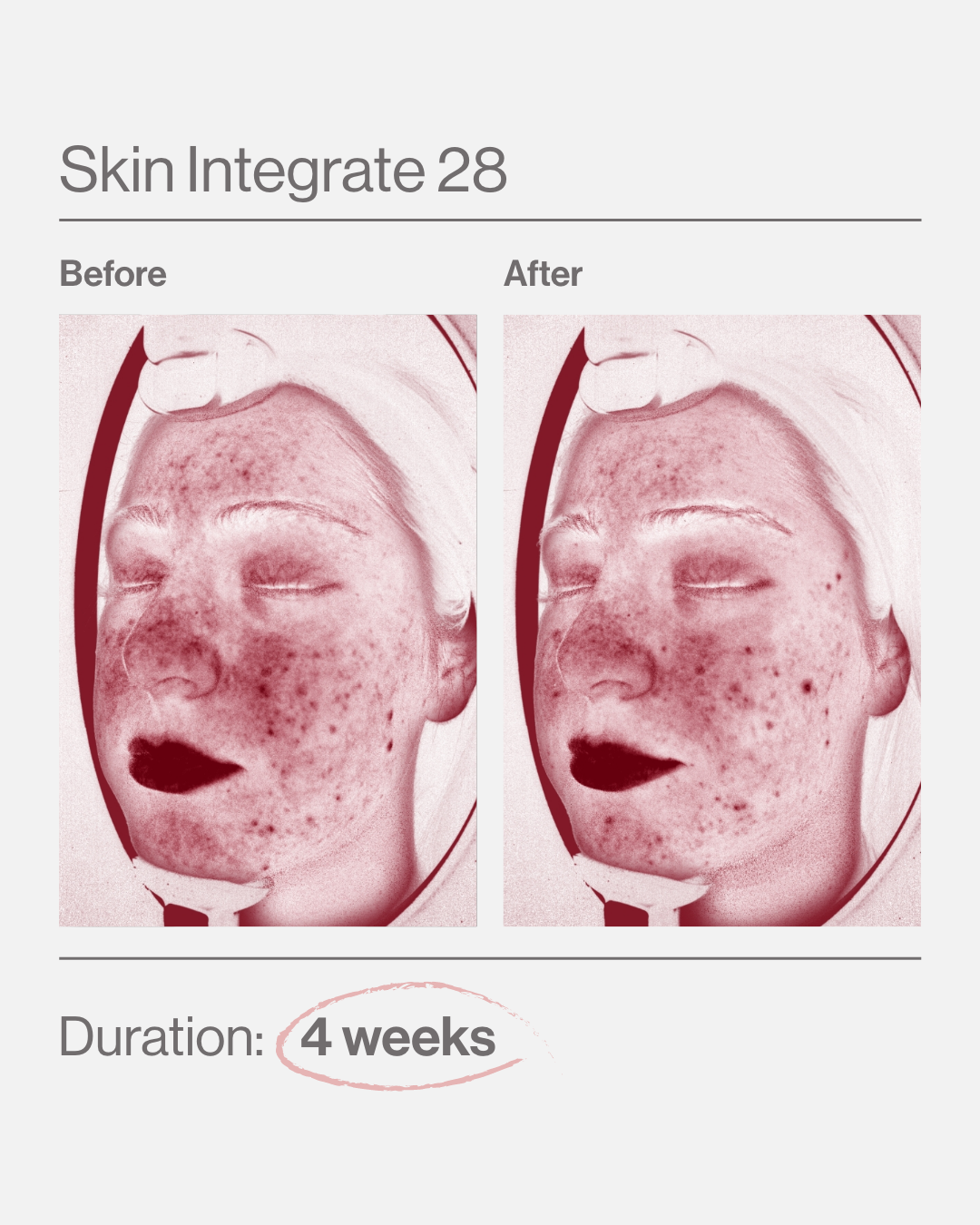 Skin Integrate 28 ελλαδα