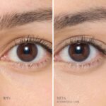 Skintuition Brightening Under Eye Concealer με Ενεργό Σύμπλεγμα Πεπτιδίων Jane Iredale 16 LM5 Main Editable BAs